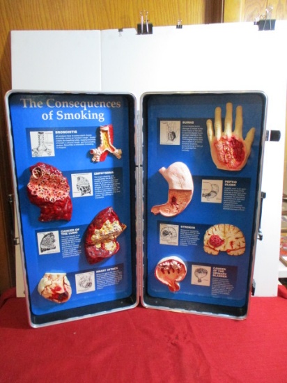Health Edco Consequences of Smoking Suitcase Style Display