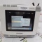 Philips IntelliVue MP5T Patient Monitor - 302577