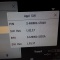 Philips IntelliVue MP20 Patient Monitor - 300180