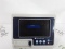 Saturn Biomedical Systems Inc Portable GVL Video Laryngoscope System - 390732