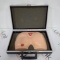 WRS Health EDCO Decubitus Ulcer Model - 475909