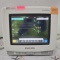 Philips Intellivue MP5 - ECG, Fast SpO2, NIBP, Press, Temp Patient Monitor - 497696