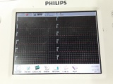 Philips PageWriter Trim III ECG Machine - 499391