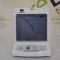 J. Morita USA, Inc. Root ZX II Dental Endodontic Apex Locator - 515928