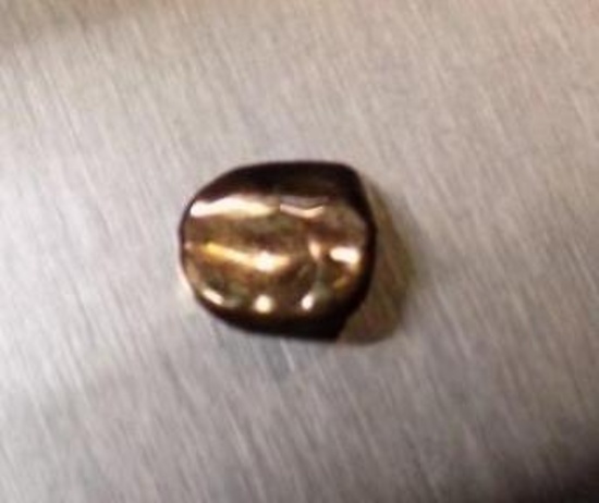 Scrap Gold Tooth 18 Kt Tested 1.97 Grams