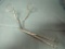 V. Mueller AS11110 Magill Forceps Adult 9