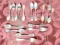 16 Antique Silver Fiddle Head Spoons