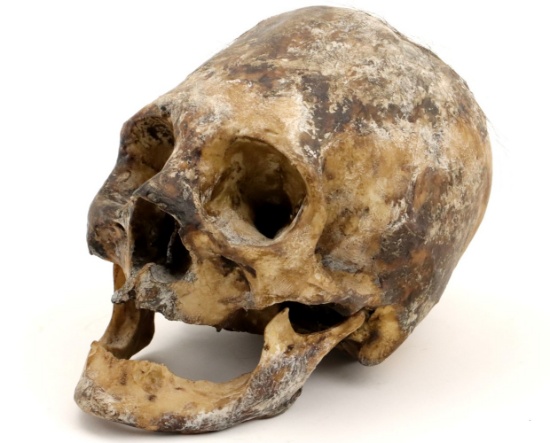 Rare Museum Display of Indonesian Dayak Headhunter's Human Skull ~ Trophy Decoration.