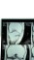 Nikki Sixx of Motley Crue Right Knee and Right Shoulder X-Ray