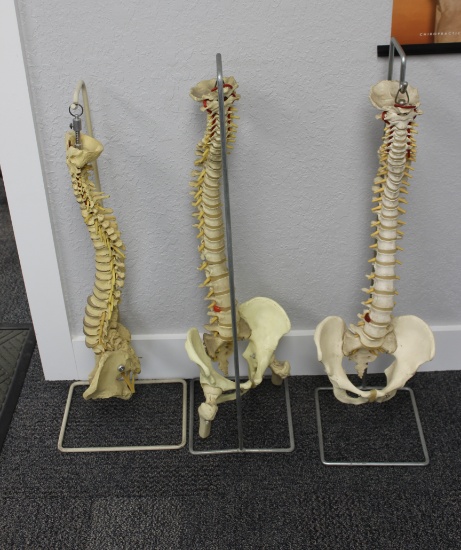 (3) Spinal Columns w/ Hangers