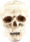 PLASTER ENDOCAST OF HUMAN SKULL WITH MEDIAL CRACK