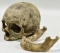 Genuine Medical School Human Skull