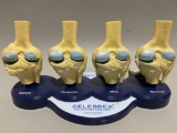 Celebrex interactive Joint demonstration model as would be found in a doctors office