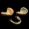 Lot of 3 antique dentures