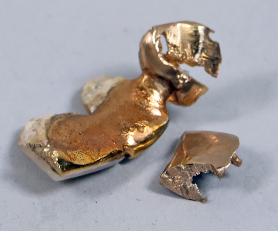 Dental Gold, 3.9 Grams