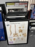 LOT CONSISTING OF MEDICAL FRAMED POSTERS