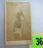 Rare Albino Woman CDV Photo (Circus?)