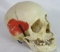 Great Antique Medical Human Skull
