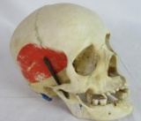 Great Antique Medical Human Skull