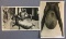 Group of 2 Real Photo Postcards Elephantiasis