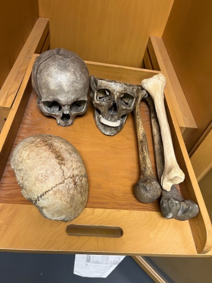 Loc: 3 Lab. Human skull and bones. This lot is located at: 601 Franklin St, Hancock, MI 49930