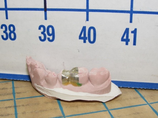 Gold Filling Mold