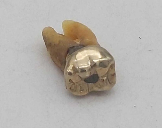 Dental Gold w/Tooth 5.47 gr