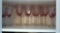 Set of Vintage Fostoria Pink Bouquet Goblets, 8 Water, 8 Wine
