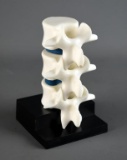 Vintage Butazolidin Vertebra Medical Model by Geigy