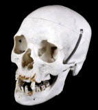 Surgeons Human Skull Specimen