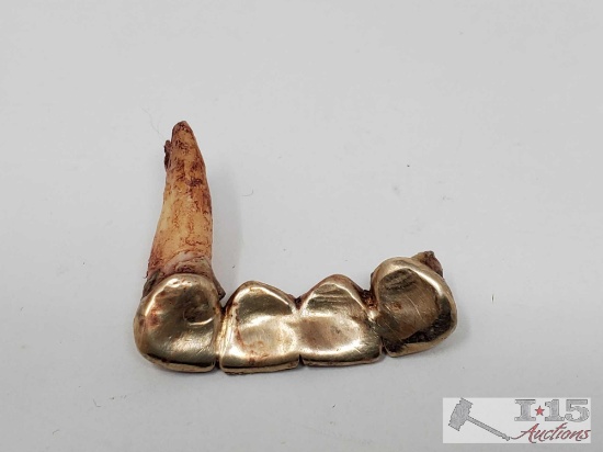 14k Gold Teeth, 5.9g