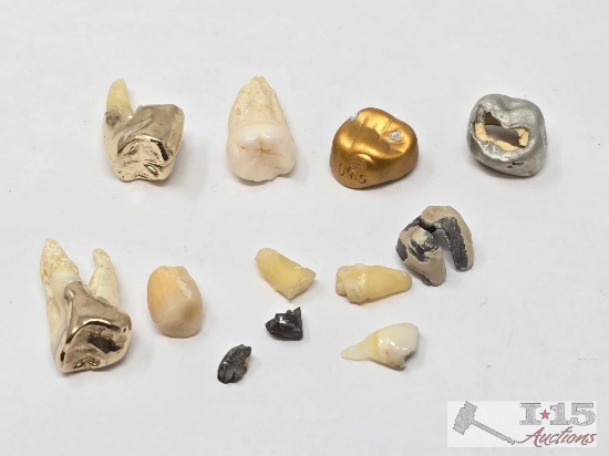 Gold & Silver Capped Teeth, 16.28g