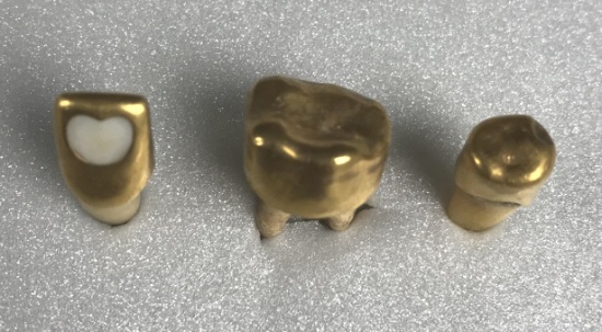Iwo Jima & Okinawa Japanese Gold Teeth (3)