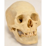 Human Skull Medical Display