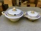Two Vintage China Covered Dishes - Franconia Bavaria