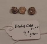Lot of Dental Gold