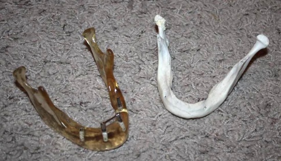Toothless Real Human Mandible for Dental Study and Replica Mandible Surgical Model
